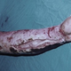 Illustration for article titled 5 real diseases that could make you act just like a zombie
